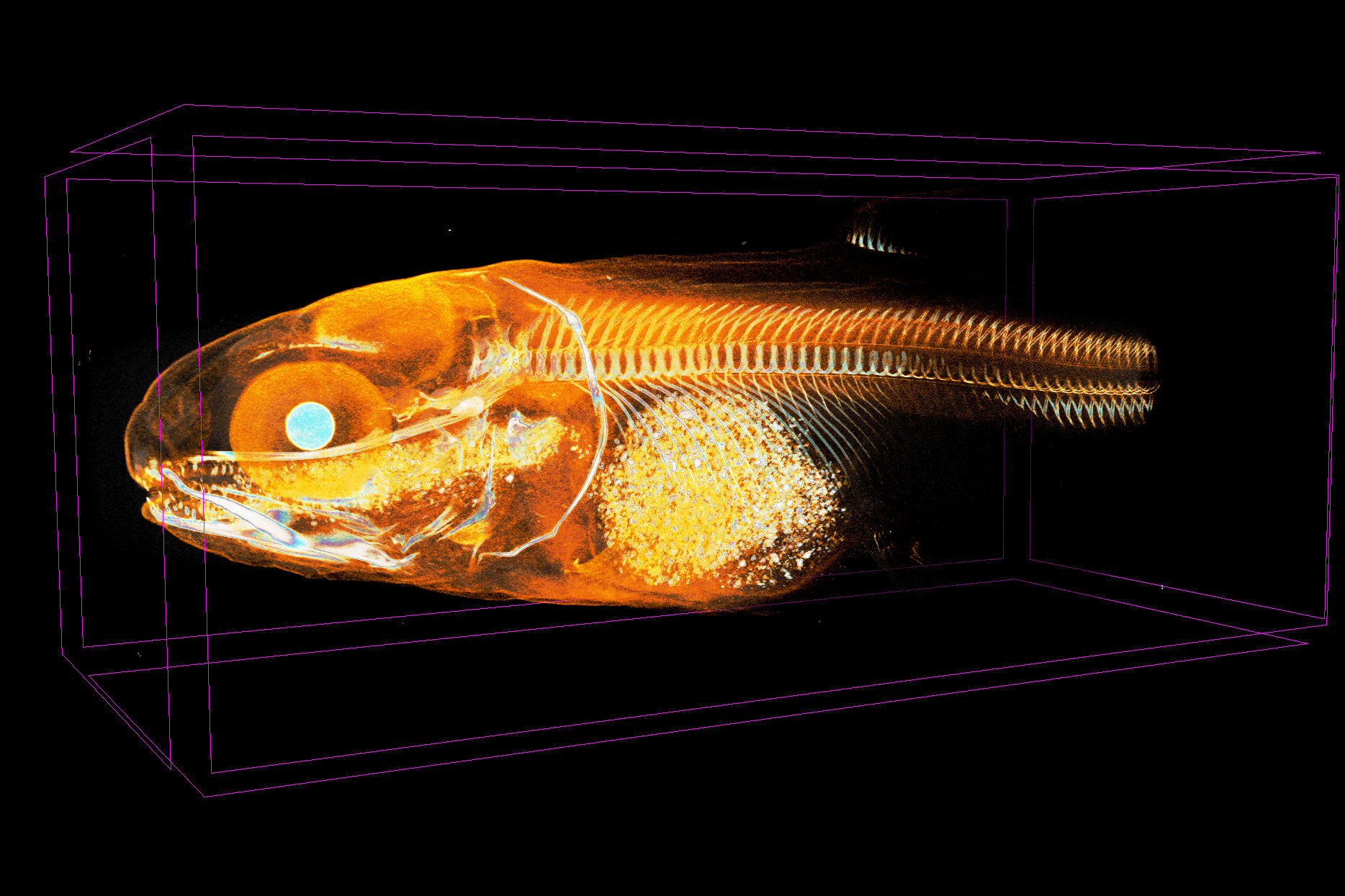 imaging-of-low-density-materials-visualization-of-soft-tissue-in